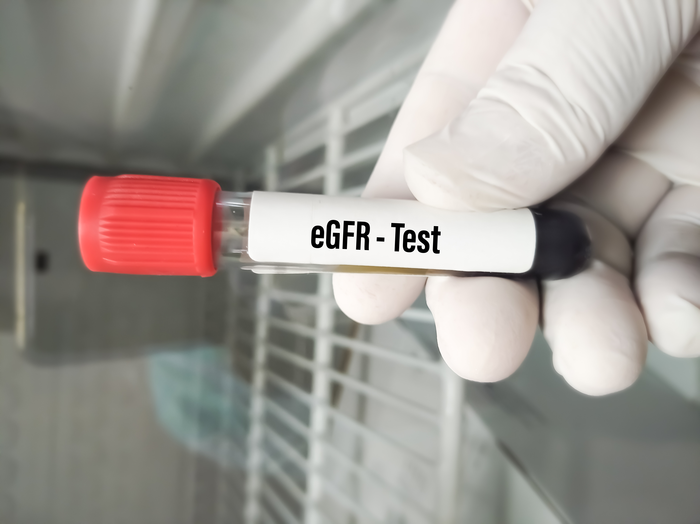 فحص GFR